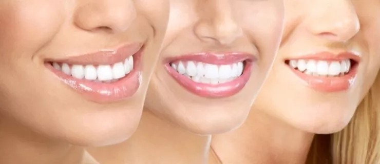 Zadbane zęby podstawą pięknego uśmiechu